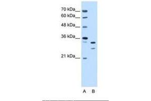 Image no. 2 for anti-Acidic (Leucine-Rich) Nuclear phosphoprotein 32 Family, Member E (ANP32E) (AA 151-200) antibody (ABIN6738242)