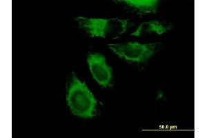 Immunofluorescence of purified MaxPab antibody to KRT7 on HeLa cell.