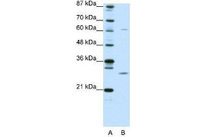 WB Suggested Anti-CRSP9  Antibody Titration: 0. (MED7 Antikörper  (N-Term))