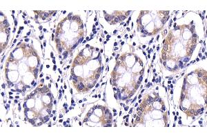 Detection of CASP9 in Human Colon Tissue using Polyclonal Antibody to Caspase 9 (CASP9)