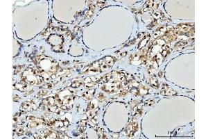 IHC analysis of TTLL12 using anti-TTLL12 antibody (ABIN7602497). (TTLL12 Antikörper  (AA 8-634))