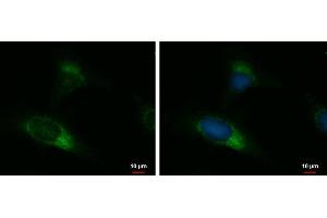 ICC/IF Image UGCGL2 antibody [N3C2], Internal detects UGCGL2 protein at endoplasmic reticulum by immunofluorescent analysis. (UGCGL2 Antikörper)