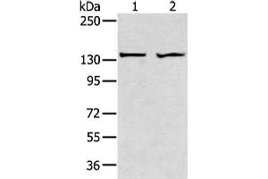 Gel: 6 % SDS-PAGE, Lysate: 40 μg, Lane 1-2: A431 and 293T cell, Primary antibody: ABIN7189660(ADAMTS2 Antibody) at dilution 1/200 dilution, Secondary antibody: Goat anti rabbit IgG at 1/8000 dilution, Exposure time: 1 minute (Adamts2 Antikörper)