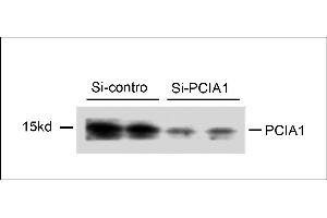 Western blot analysis of extracts from 293T cells that were transfected with si-control or transfected si-PCIA1, using rabbit polyclonal PCIA1 Antibody (Center) (ABIN658015 and ABIN2846953). (DDA1 Antikörper  (AA 11-40))