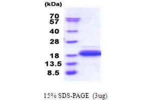 SDS-PAGE (SDS) image for Dpy-30 Homolog (DPY30) (AA 1-99) protein (His tag) (ABIN5853858) (DPY30 Protein (AA 1-99) (His tag))