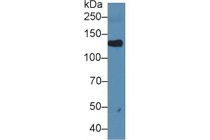 Western blot analysis of Rat Serum, using Rat LIFR Antibody (1 µg/ml) and HRP-conjugated Goat Anti-Rabbit antibody ( (LIFR Antikörper  (AA 382-486))
