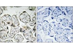 Immunohistochemistry analysis of paraffin-embedded human placenta tissue, using MT-ND1 Antibody. (MT-ND1 Antikörper  (AA 176-225))