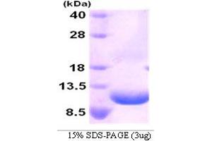 SDS-PAGE (SDS) image for Chemokine (C-X-C Motif) Ligand 2 (CXCL2) (AA 35-107) protein (His tag) (ABIN666759) (CXCL2 Protein (AA 35-107) (His tag))