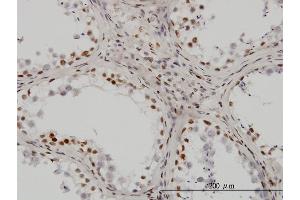 Immunostaining (ISt) image for anti-Upstream Binding Transcription Factor, RNA Polymerase I (UBTF) (AA 551-650) antibody (ABIN563329)