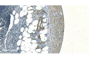 IHC analysis of H Cadherin/CDH13 using anti-H Cadherin/CDH13 antibody (ABIN7600095). (Cadherin 13 Antikörper  (AA 149-692))