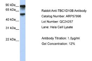 WB Suggested Anti-TBC1D10B  Antibody Titration: 0. (TBC1D10B Antikörper  (C-Term))