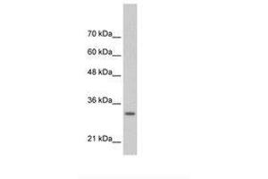 Image no. 2 for anti-Transcription Factor MafB (MAFB) (AA 41-90) antibody (ABIN6736309) (MAFB Antikörper  (AA 41-90))