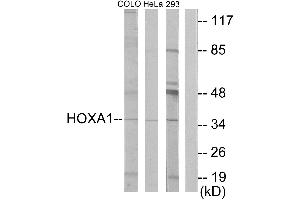Western blot analysis of extracts from COLO cells, HeLa/ cells and 293 cells, using HOXA1 antibody. (HOXA1 Antikörper  (Internal Region))