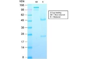 SDS-PAGE Analysis Purified Growth Hormone Recombinant Mouse Monoclonal (rGH/1450). (Rekombinanter Growth Hormone 1 Antikörper  (AA 58-187))