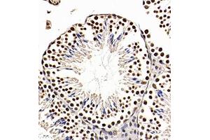 Immunohistochemistry of paraffin embedded mouse testis using Api5 (ABIN7073094) at dilution of 1:350 (400x lens) (Apoptosis Inhibitor 5 Antikörper)