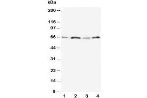 Western blot testing of OPN antibody and Lane 1:  MM231;  2: HeLa;  3: Jurkat;  4: COLO320 cell lysate.
