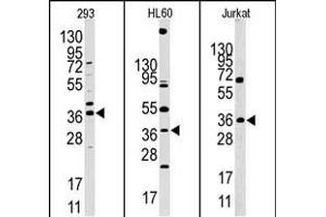 Western blot analysis of anti-HIF1AN (N-term) Pab in 293, HL60 and Jurkat cell line lysates. (HIF1AN Antikörper  (N-Term))
