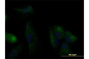Immunofluorescence (IF) image for anti-Keratin 20 (KRT20) (AA 1-424) antibody (ABIN565739)