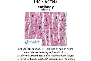 Image no. 1 for anti-Actinin, alpha 2 (ACTN2) (AA 215-500) antibody (ABIN1731491) (ACTN2 Antikörper  (AA 215-500))