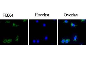 Immunofluorescence staining of NIH/3T3 cells with FBX4 polyclonal antibody  . (FBXO4 Antikörper  (N-Term))