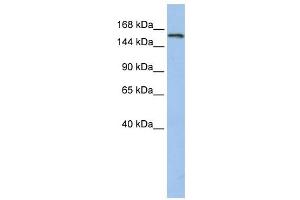 UBE3A antibody used at 1 ug/ml to detect target protein. (ube3a Antikörper  (N-Term))