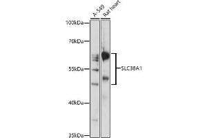 Western blot analysis of extracts of various cell lines, using SLC38 antibody (ABIN7270455) at 1:1000 dilution. (SLC38A1 Antikörper  (AA 1-70))
