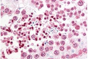 Anti-INADL antibody IHC staining of human testis. (PATJ Antikörper  (AA 2-14))