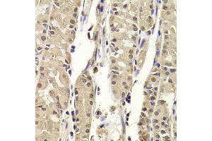 Immunohistochemistry of paraffin-embedded Human gastric using BLZF1 antibody at dilution of 1:100 (x400 lens). (BLZF1 Antikörper)