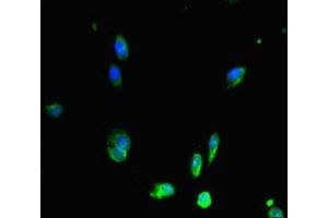 Immunofluorescent analysis of Hela cells using ABIN7150287 at dilution of 1:100 and Alexa Fluor 488-congugated AffiniPure Goat Anti-Rabbit IgG(H+L) (RAD51 Antikörper  (AA 1-228))
