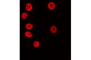 ABIN6274707 staining COLO205 by IF/ICC. (KLF7 Antikörper  (Internal Region))