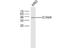 K562 lysates probed with ICAM4 Polyclonal Antibody, Uconjugated  at 1:300 overnight at 4°C followed by a conjugated secondary antibody at 1:10000 for 60 minutes at 37°C.