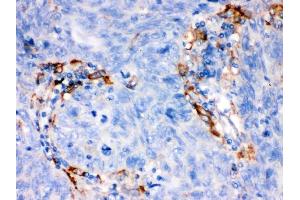 IHC analysis of FCGRT using anti-FCGRT antibody (ABIN3044521). (FcRn Antikörper  (AA 56-291))