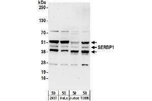 Western Blotting (WB) image for anti-SERPINE1 mRNA Binding Protein 1 (SERBP1) (AA 100-150) antibody (ABIN7454987)