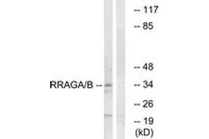 Western blot analysis of extracts from HepG2 cells, using RRAGA/B Antibody. (RRAGA/B Antikörper  (AA 264-313))