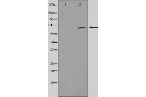Western blot analysis on LOVO cell lysate using AKAP2 Antibody,The lane on the left is treated with the antigen-specific peptide. (AKAP2 Antikörper  (N-Term))