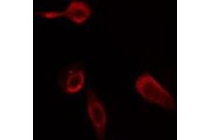 ABIN6275785 staining Hela cells by IF/ICC. (Phospholipase C beta 2 Antikörper  (Internal Region))