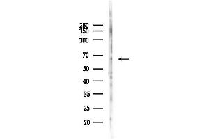 Western blot analysis of lysates from HepG2 cells(heat-shock,45 min treatment), using Collagen XXV alpha 1 Antibody at 1/1000 dilution.