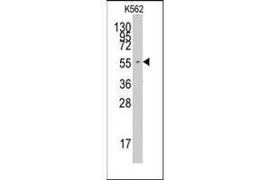 Western blot analysis of anti-FARSA Pab in K562 cell line lysates (35ug/lane). (Phenylalanyl-tRNA Synthetase, alpha Subunit (FARSA) (N-Term) Antikörper)