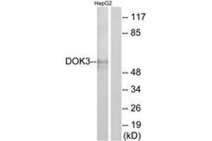 Western blot analysis of extracts from HepG2 cells, using DOK3 Antibody. (DOK3 Antikörper  (AA 101-150))