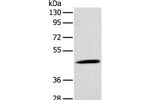 Western blot analysis of Rat kidney tissue using CCBL1 Polyclonal Antibody at dilution of 1:300 (CCBL1 Antikörper)