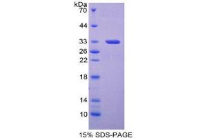 SDS-PAGE (SDS) image for Periplakin (PPL) (AA 1501-1754) protein (His tag) (ABIN1878638)
