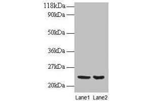 Western blot All lanes: PRDX1 antibody at 2 μg/mL Lane 1: EC109 whole cell lysate Lane 2: 293T whole cell lysate Secondary Goat polyclonal to rabbit IgG at 1/15000 dilution Predicted band size: 23 kDa Observed band size: 23 kDa (Peroxiredoxin 1 Antikörper  (AA 1-199))