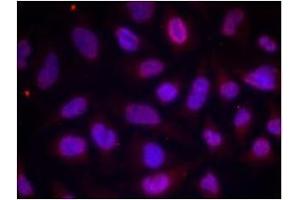 Image no. 1 for anti-Myocyte Enhancer Factor 2A (MEF2A) (pThr312) antibody (ABIN196682) (MEF2A Antikörper  (pThr312))