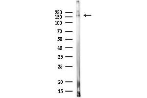 anti-G Patch Domain Containing 8 (GPATCH8) (Internal Region) antibody