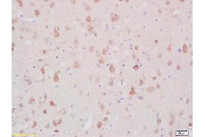 Formalin-fixed and paraffin embedded rat brain labeled with Anti-MARCKS Polyclonal Antibody, Unconjugated (ABIN681538) at 1:200 followed by conjugation to the secondary antibody and DAB staining