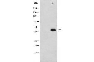 Western blot analysis of p47 phox phosphorylation expression in nocodazole treated HeLa whole cell lysates,The lane on the left is treated with the antigen-specific peptide. (NCF1 Antikörper  (pSer359))