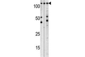 Western Blotting (WB) image for anti-Chromosome Segregation 1-Like (CSE1L) antibody (ABIN3000895) (CSE1L Antikörper)