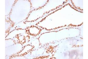 IHC: Formalin-fixed, paraffin-embedded human thyroid stained with recombinant NKX2. (NKX2-1 Antikörper)