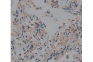 Used in DAB staining on fromalin fixed paraffin- embedded lung tissue (DICER1 Antikörper  (AA 6-290))