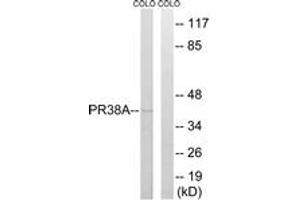 Western Blotting (WB) image for anti-PRP38 Pre-mRNA Processing Factor 38 (Yeast) Domain Containing A (PRPF38A) (AA 104-153) antibody (ABIN2890528) (PRPF38A Antikörper  (AA 104-153))